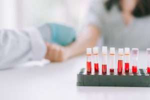 Analisi del sangue Vitiligine